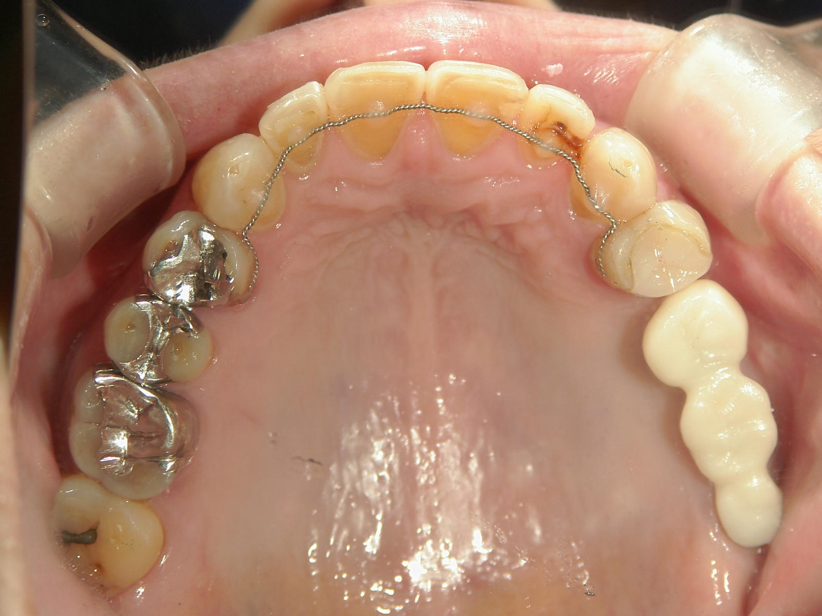 非抜歯症例（10）